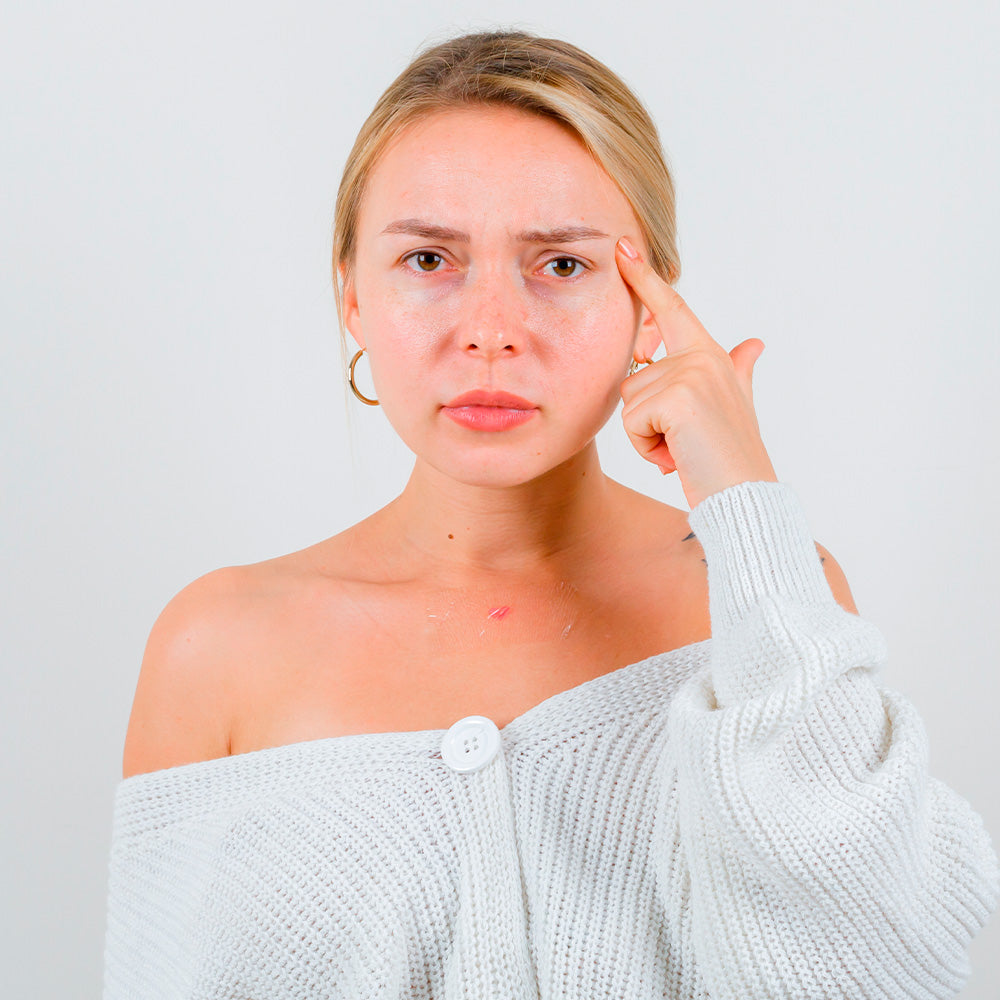 Hypersensitive skin